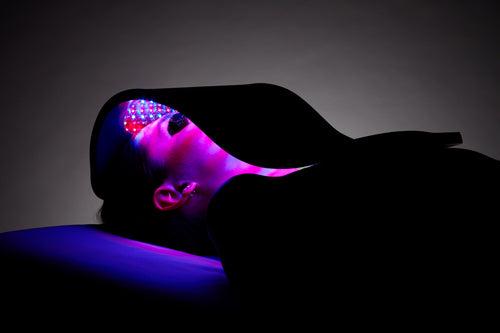 LED Red Light Therapy and Hyperpigmentation