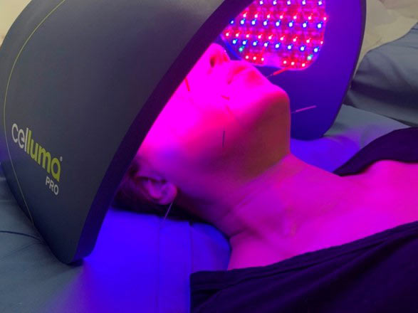 A patient combining light therapy with acupuncture