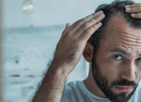 A man is worried about his hair loss